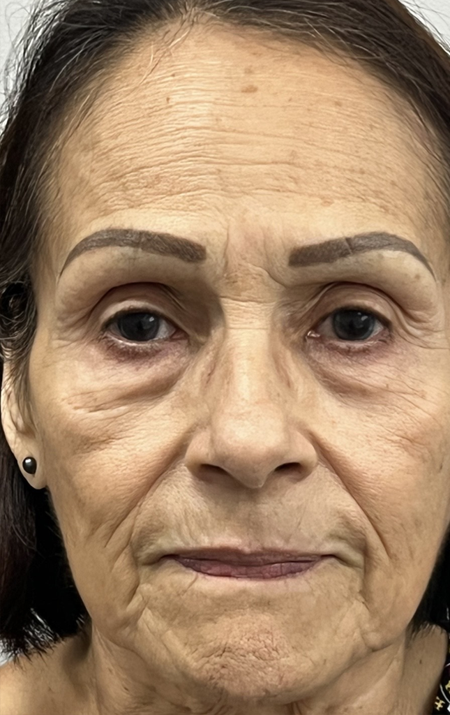 Imagem antes de usar GlowLift